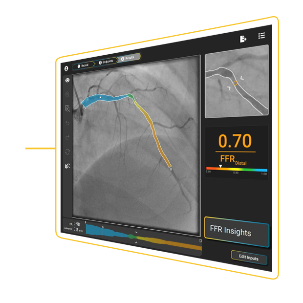 0.70 angled 0.70 angled