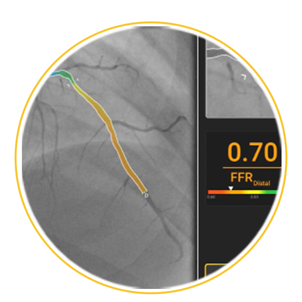0.70 close up 0.70 close up