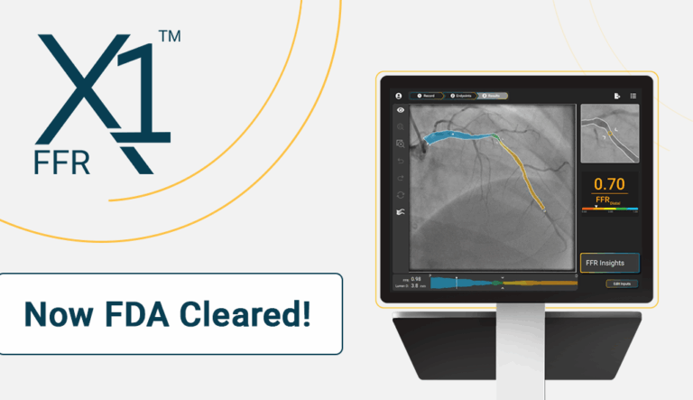 News - SpectraWAVE, Inc.