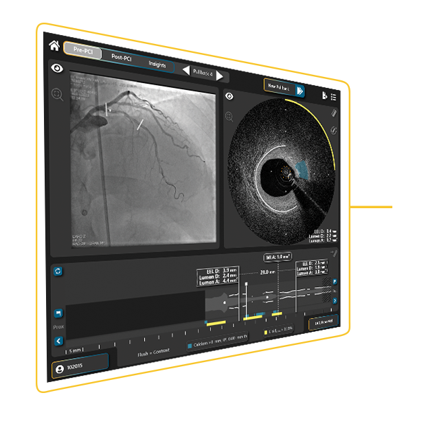 image angled image angled